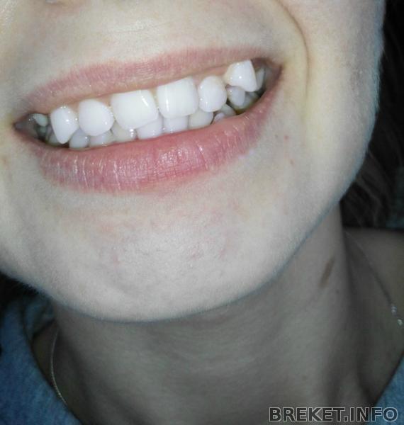 2014090118574oo2.jpg