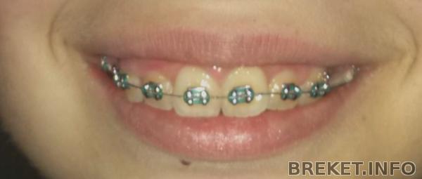 cam00363.jpg