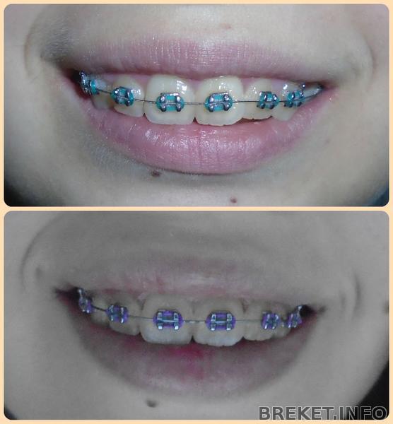fotor1125121028.jpg